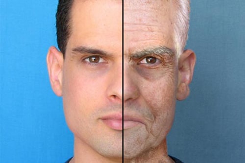 Anti-aging program