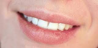 ترک گوشه لب نشانه چیست؟