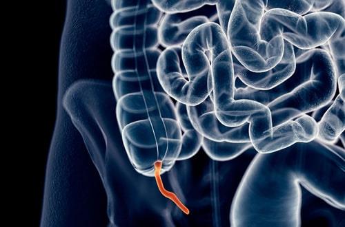 Appendix